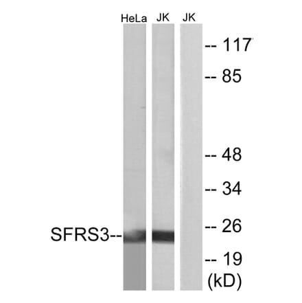 Western Blot - Anti-SFRS3 Antibody (C10809) - Antibodies.com