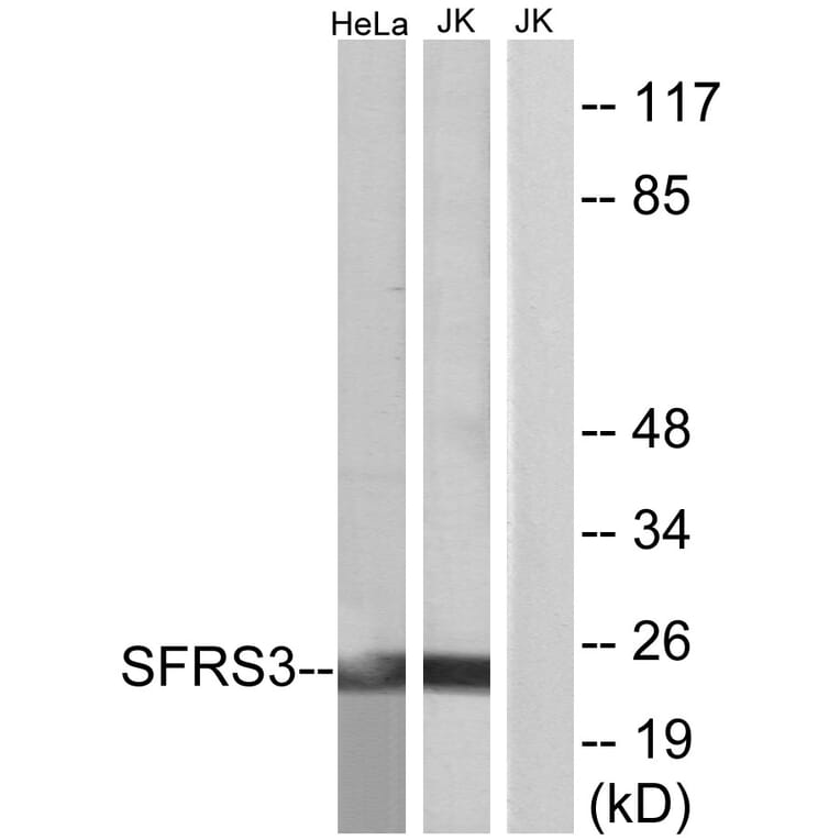 Western Blot - Anti-SFRS3 Antibody (C10809) - Antibodies.com