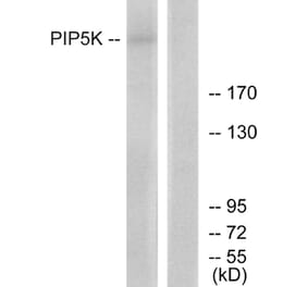 Western Blot - Anti-PIP5K Antibody (C11935) - Antibodies.com