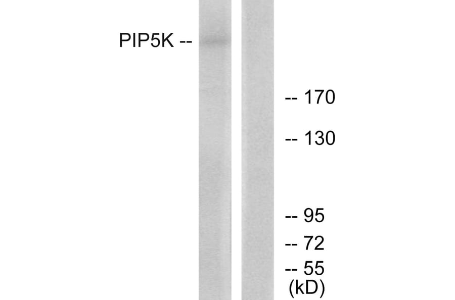 Western Blot - Anti-PIP5K Antibody (C11935) - Antibodies.com