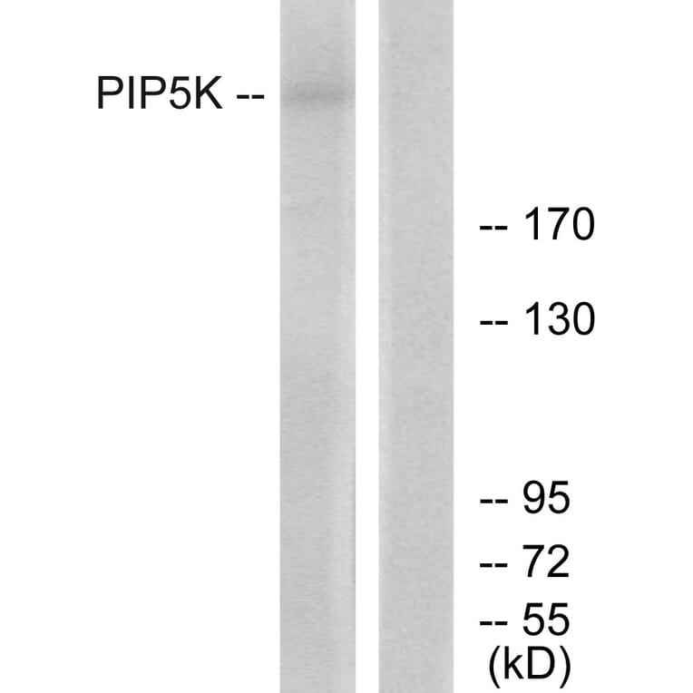 Western Blot - Anti-PIP5K Antibody (C11935) - Antibodies.com