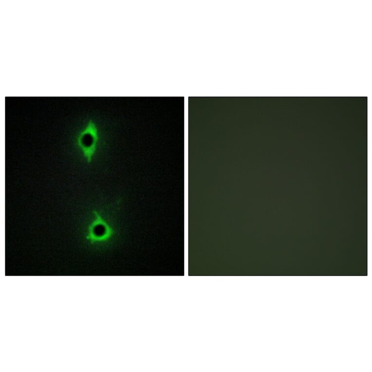 Immunofluorescence - Anti-PIP5K Antibody (C11935) - Antibodies.com