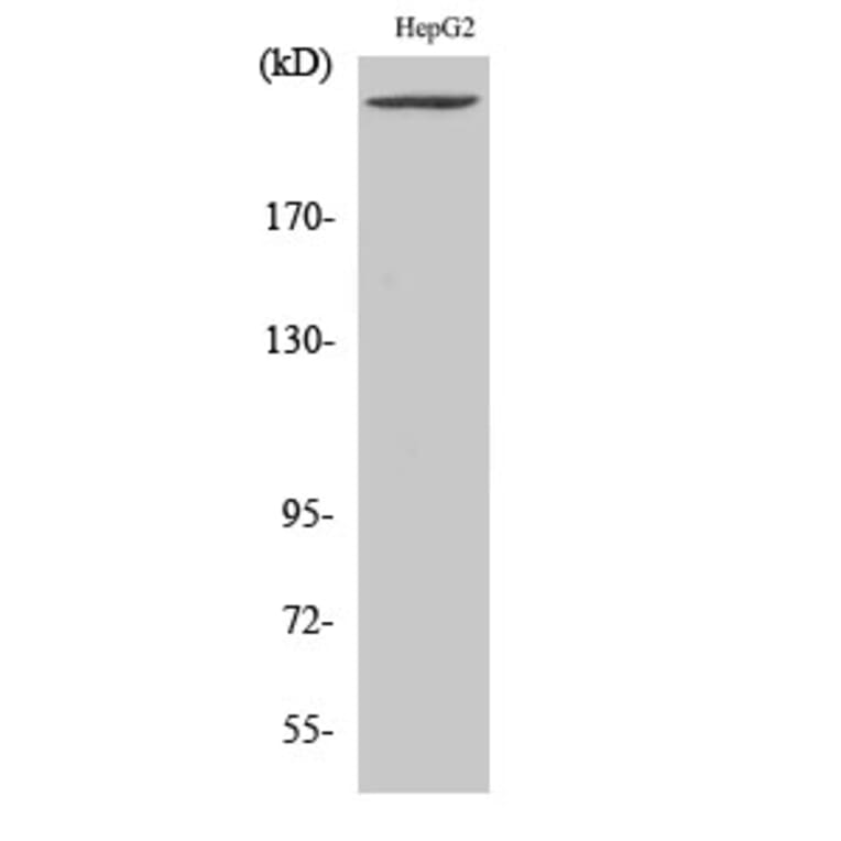 Western Blot - Anti-PIP5K Antibody (C11935) - Antibodies.com