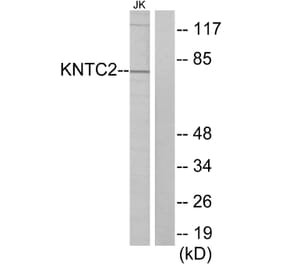 Western Blot - Anti-KNTC2 Antibody (C10051) - Antibodies.com