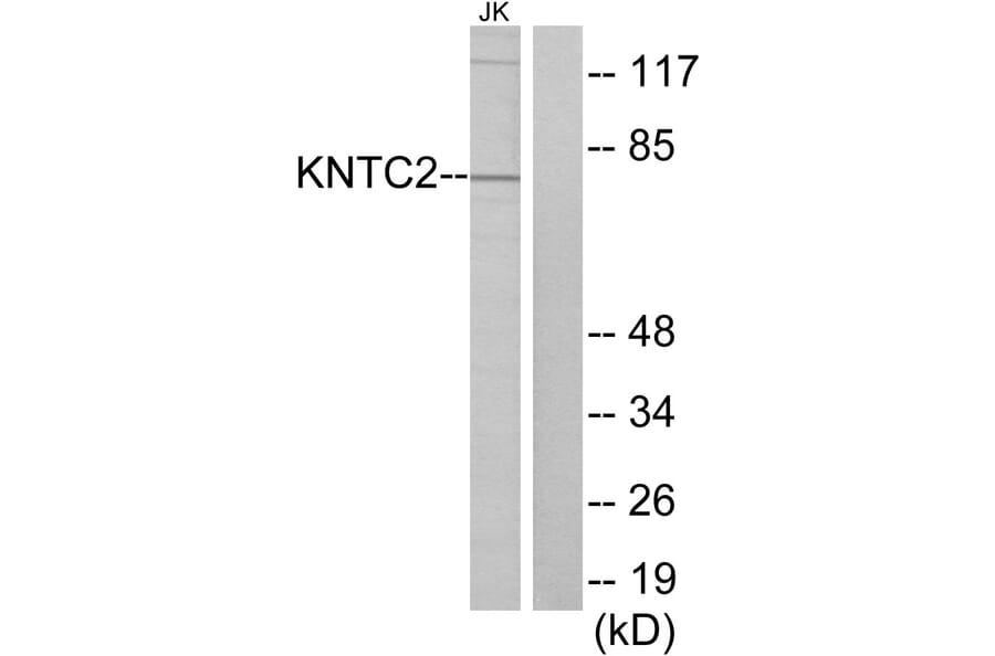 Western Blot - Anti-KNTC2 Antibody (C10051) - Antibodies.com