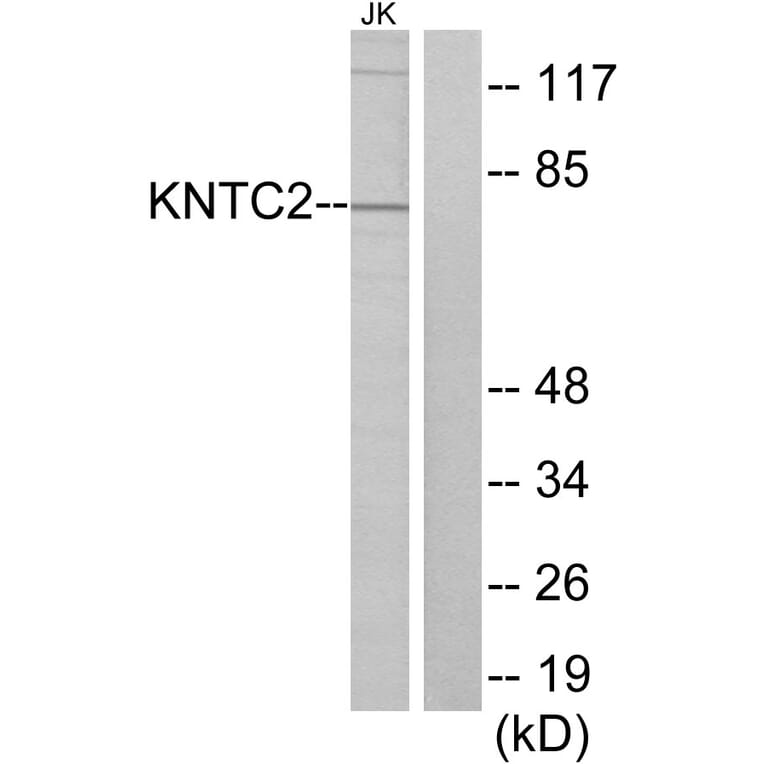 Western Blot - Anti-KNTC2 Antibody (C10051) - Antibodies.com