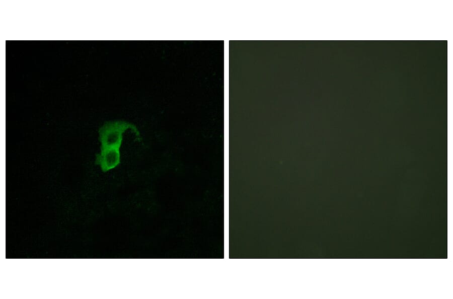 Immunofluorescence - Anti-GPR87 Antibody (G358) - Antibodies.com