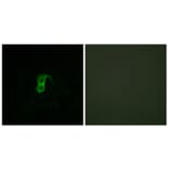 Immunofluorescence - Anti-GPR87 Antibody (G358) - Antibodies.com