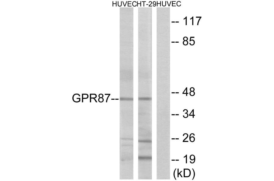 Western Blot - Anti-GPR87 Antibody (G358) - Antibodies.com