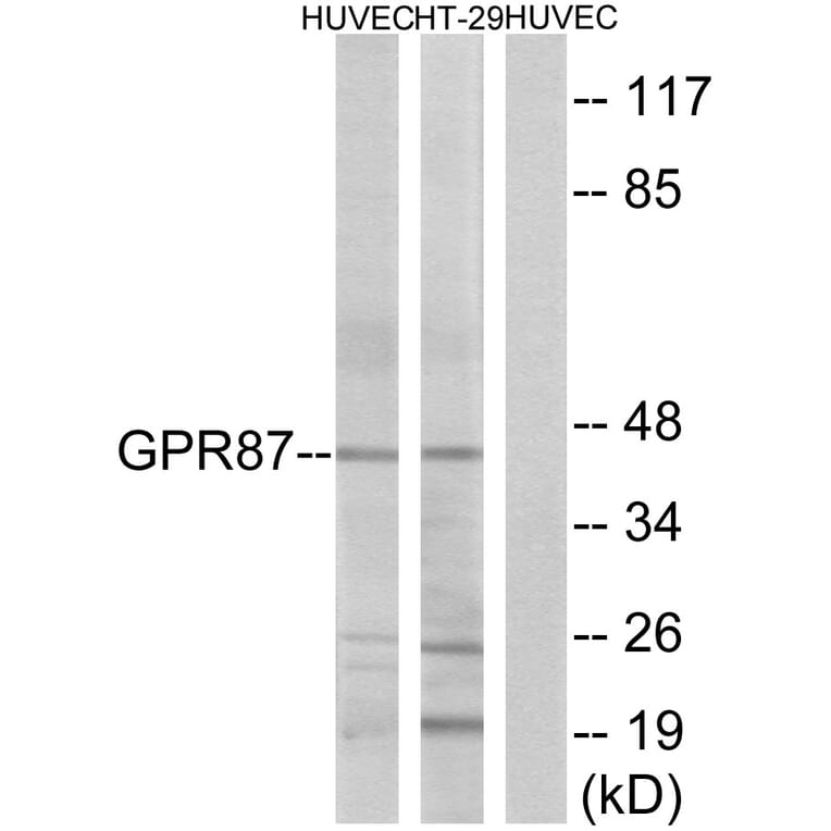 Western Blot - Anti-GPR87 Antibody (G358) - Antibodies.com