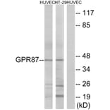 Western Blot - Anti-GPR87 Antibody (G358) - Antibodies.com