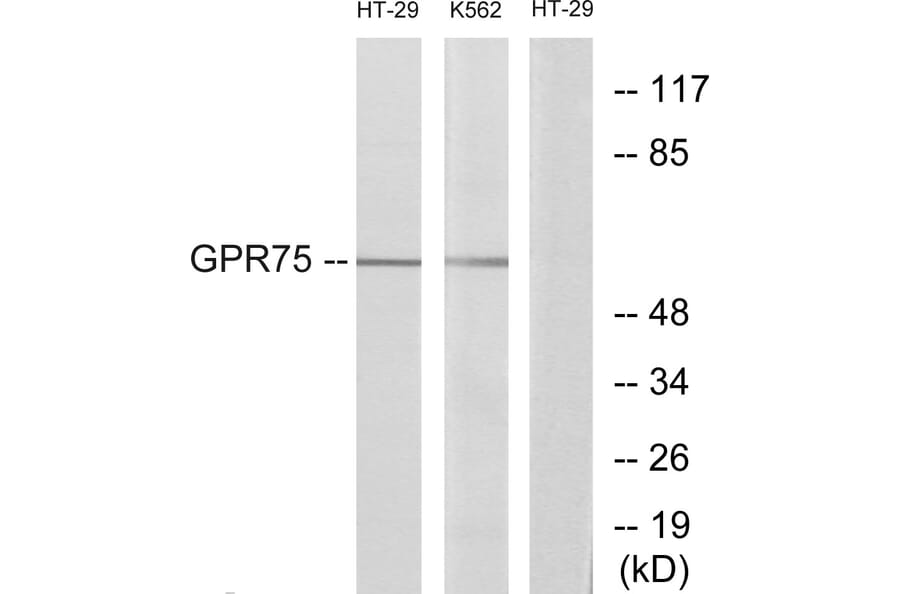 Western Blot - Anti-GPR75 Antibody (G351) - Antibodies.com