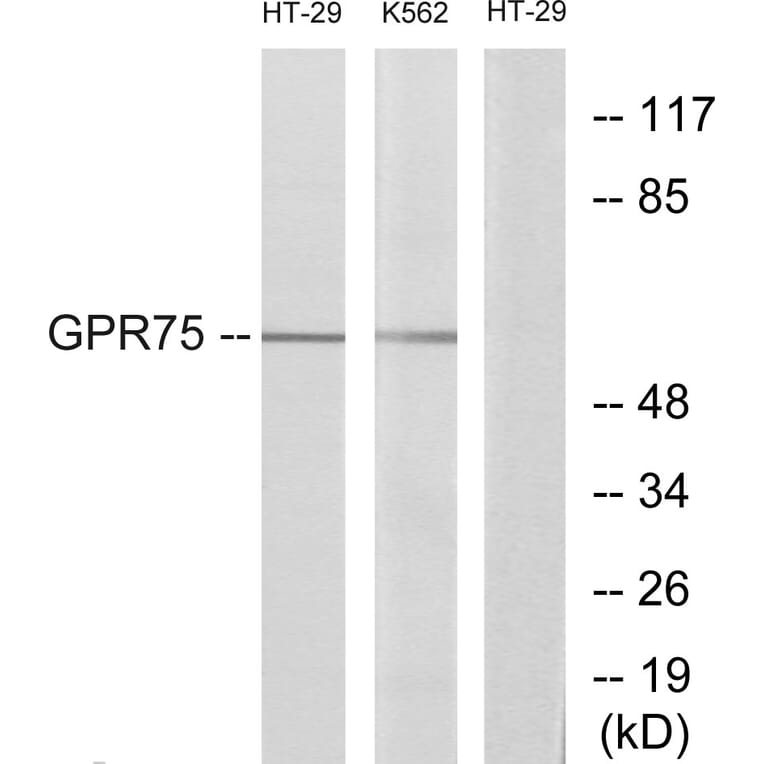 Western Blot - Anti-GPR75 Antibody (G351) - Antibodies.com
