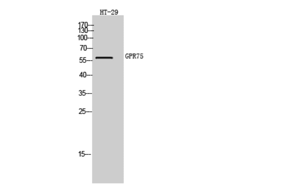 Western Blot - Anti-GPR75 Antibody (G351) - Antibodies.com