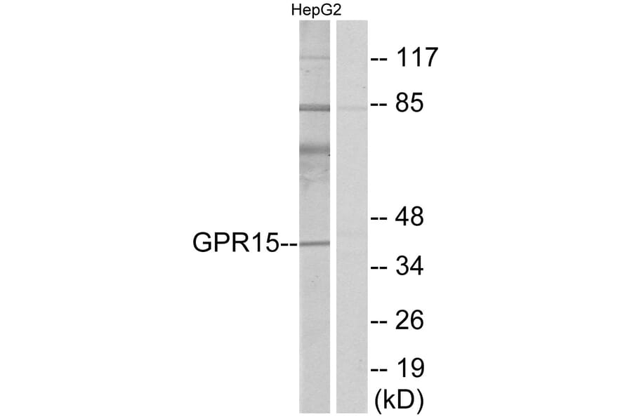 Western Blot - Anti-GPR15 Antibody (G324) - Antibodies.com