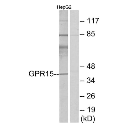 Western Blot - Anti-GPR15 Antibody (G324) - Antibodies.com