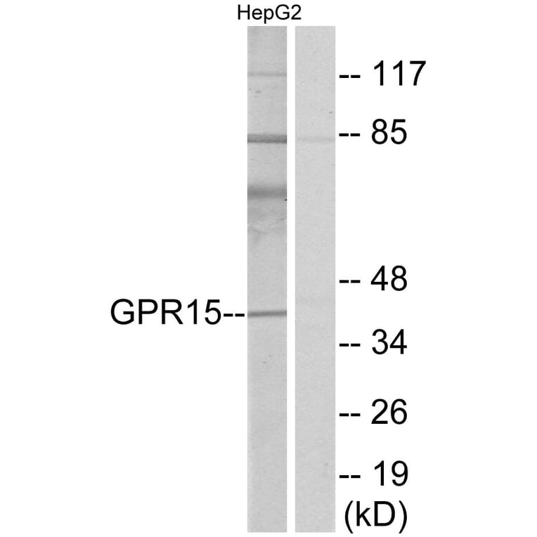 Western Blot - Anti-GPR15 Antibody (G324) - Antibodies.com
