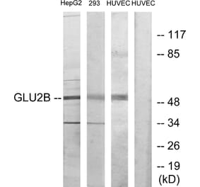 Western Blot - Anti-GLU2B Antibody (C10365) - Antibodies.com