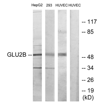 Western Blot - Anti-GLU2B Antibody (C10365) - Antibodies.com
