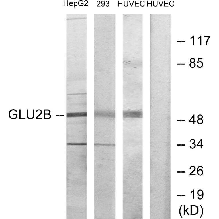Western Blot - Anti-GLU2B Antibody (C10365) - Antibodies.com