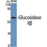 Western Blot - Anti-GLU2B Antibody (C10365) - Antibodies.com