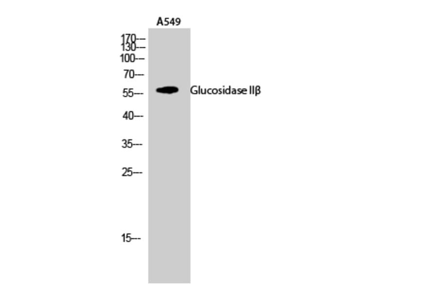 Western Blot - Anti-GLU2B Antibody (C10365) - Antibodies.com
