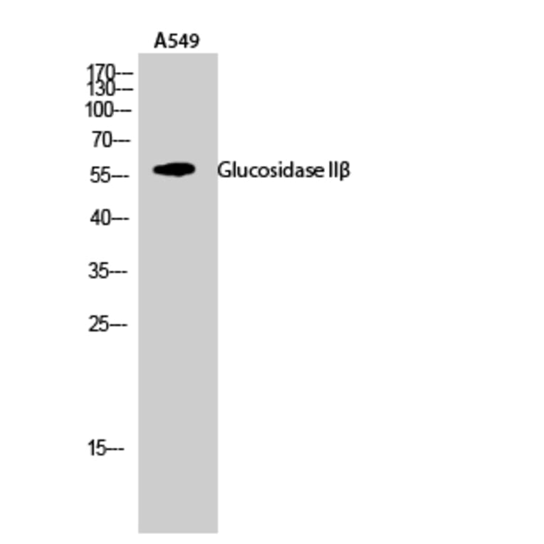 Western Blot - Anti-GLU2B Antibody (C10365) - Antibodies.com