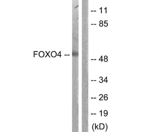 Western Blot - Anti-FOXO4 Antibody (B1149) - Antibodies.com