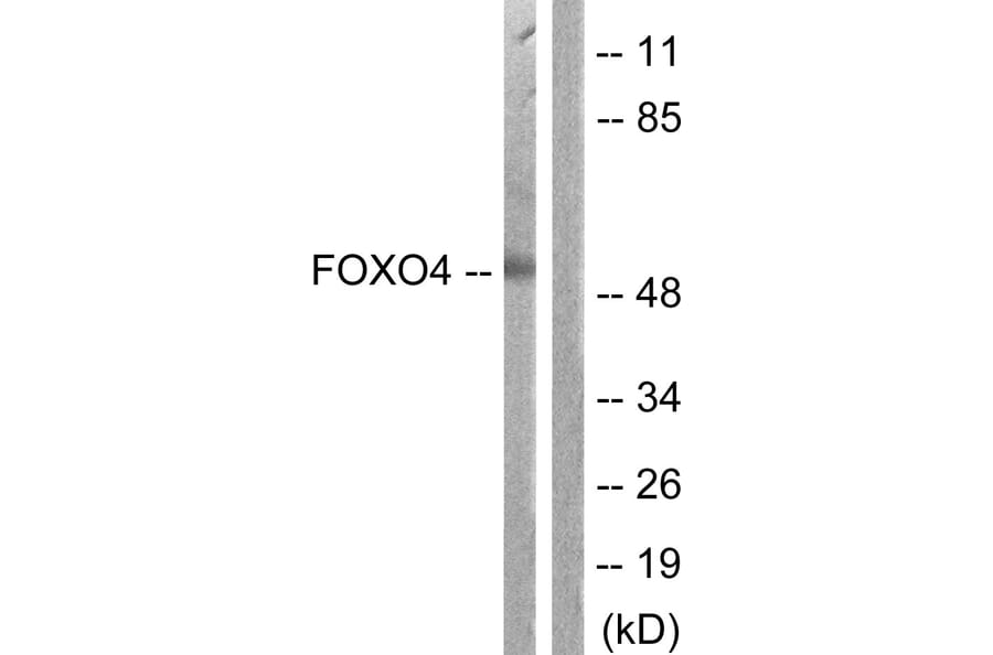Western Blot - Anti-FOXO4 Antibody (B1149) - Antibodies.com