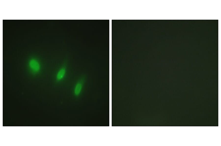 Immunofluorescence - Anti-FOXO4 Antibody (B1149) - Antibodies.com