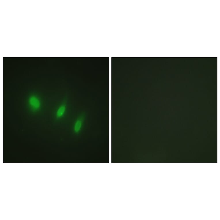 Immunofluorescence - Anti-FOXO4 Antibody (B1149) - Antibodies.com