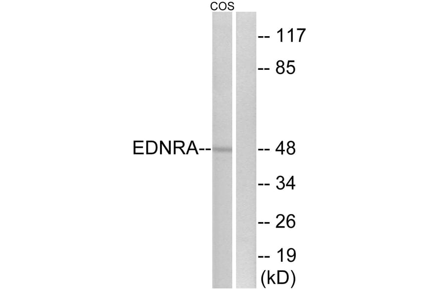 Western Blot - Anti-EDNRA Antibody (G241) - Antibodies.com