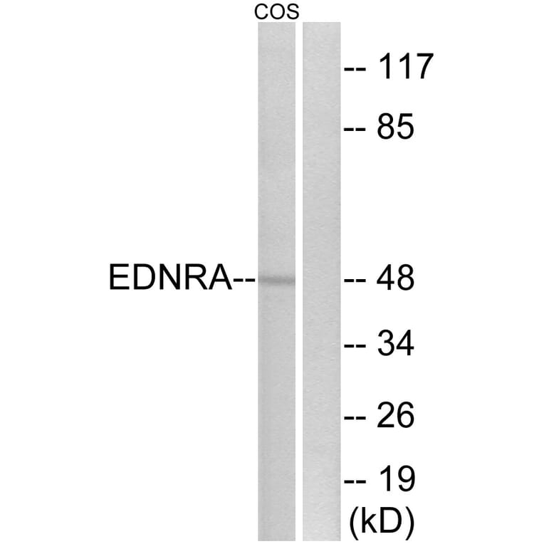 Western Blot - Anti-EDNRA Antibody (G241) - Antibodies.com