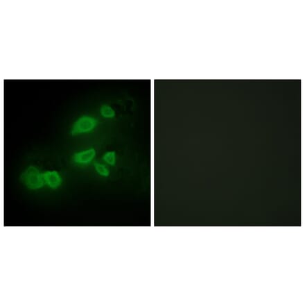 Immunofluorescence - Anti-CDCP1 Antibody (C11696) - Antibodies.com