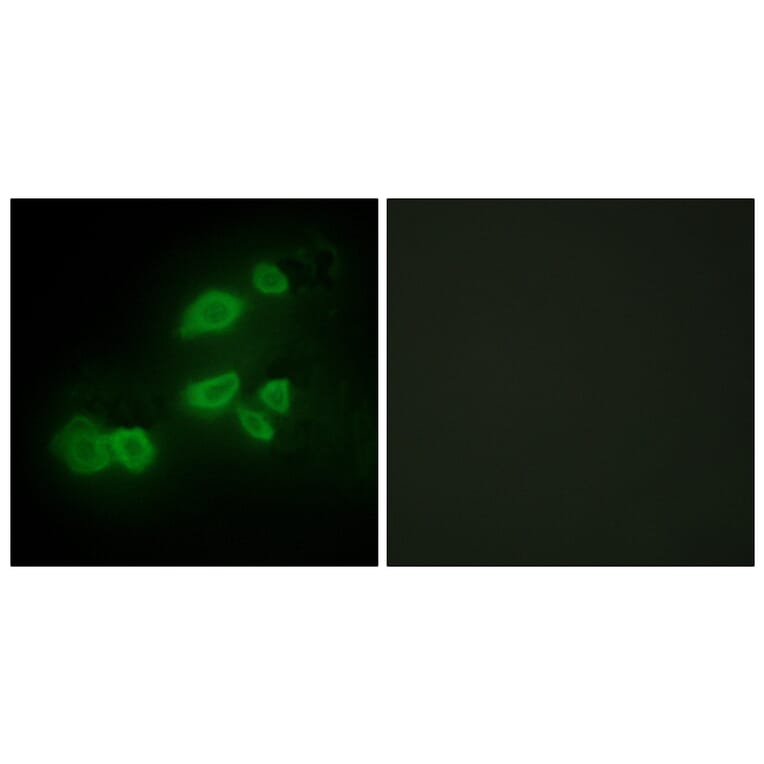 Immunofluorescence - Anti-CDCP1 Antibody (C11696) - Antibodies.com