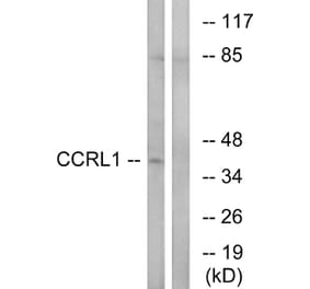 Western Blot - Anti-CCRL1 Antibody (C12133) - Antibodies.com