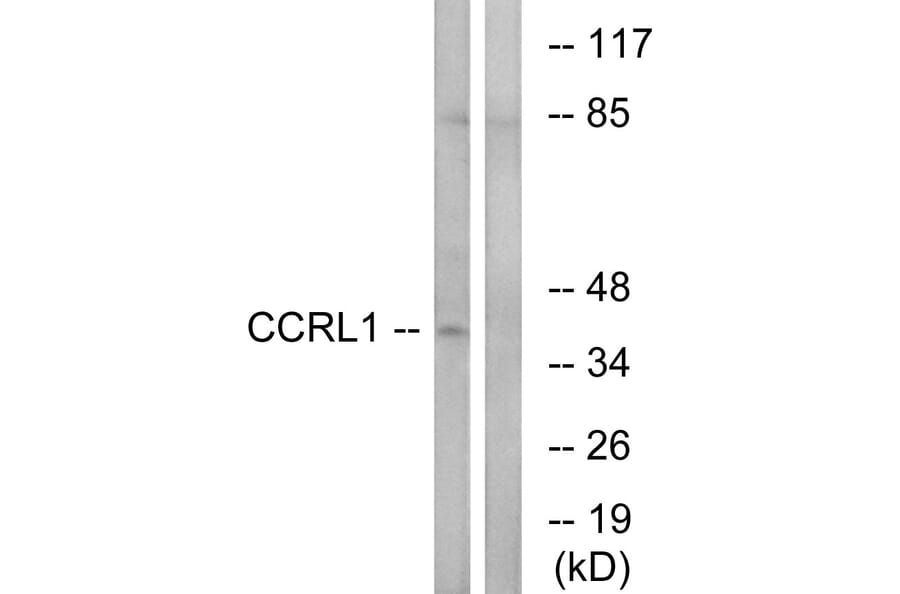 Western Blot - Anti-CCRL1 Antibody (C12133) - Antibodies.com