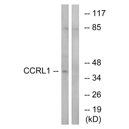 Western Blot - Anti-CCRL1 Antibody (C12133) - Antibodies.com