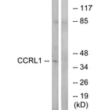Western Blot - Anti-CCRL1 Antibody (C12133) - Antibodies.com