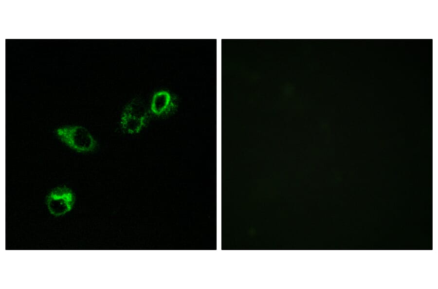 Immunofluorescence - Anti-CCRL1 Antibody (C12133) - Antibodies.com