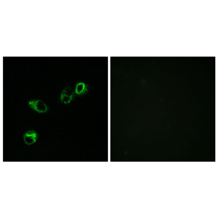 Immunofluorescence - Anti-CCRL1 Antibody (C12133) - Antibodies.com