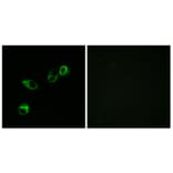Immunofluorescence - Anti-CCRL1 Antibody (C12133) - Antibodies.com