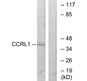 Western Blot - Anti-CCRL1 Antibody (G060) - Antibodies.com