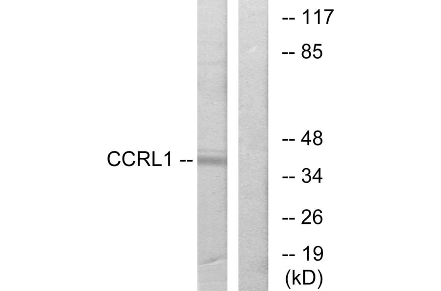 Western Blot - Anti-CCRL1 Antibody (G060) - Antibodies.com