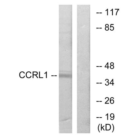 Western Blot - Anti-CCRL1 Antibody (G060) - Antibodies.com