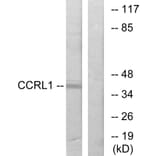 Western Blot - Anti-CCRL1 Antibody (G060) - Antibodies.com