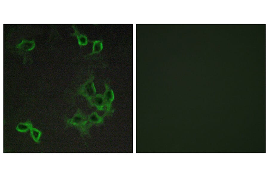 Immunofluorescence - Anti-CCRL1 Antibody (G060) - Antibodies.com