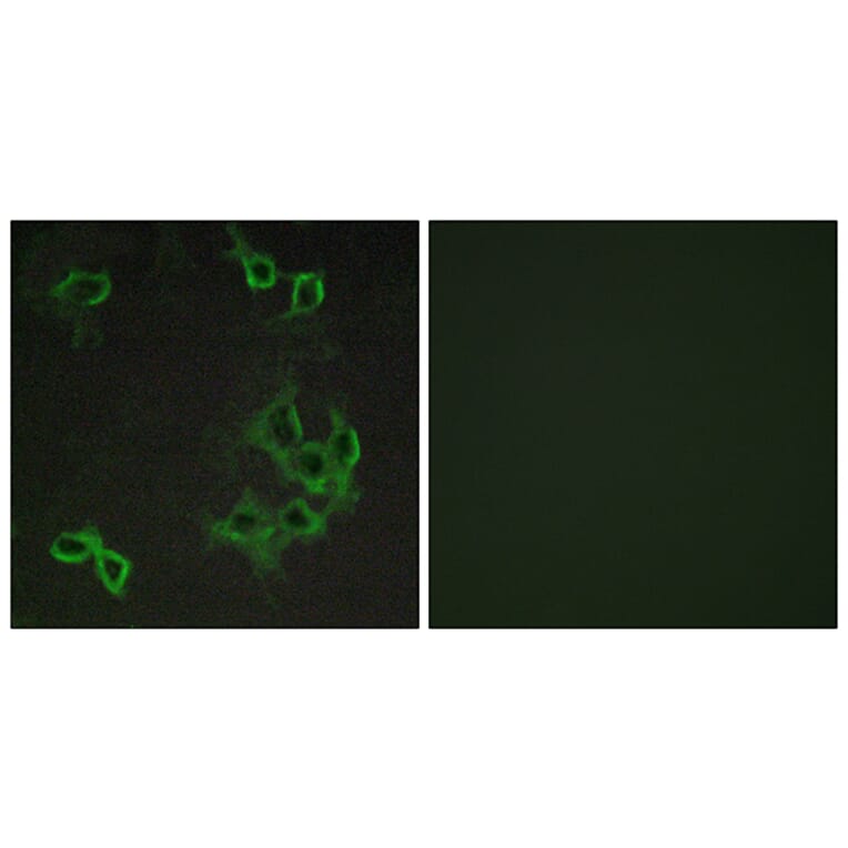Immunofluorescence - Anti-CCRL1 Antibody (G060) - Antibodies.com