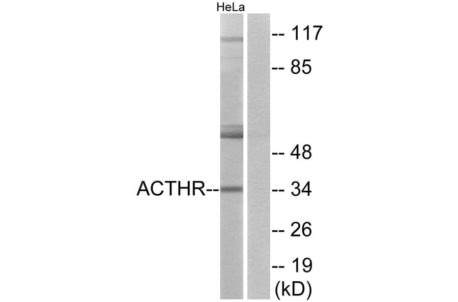 Western Blot - Anti-ACTHR Antibody (G210) - Antibodies.com