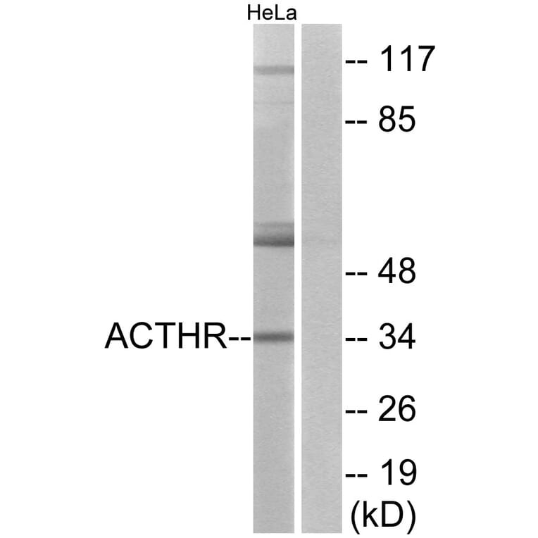 Western Blot - Anti-ACTHR Antibody (G210) - Antibodies.com